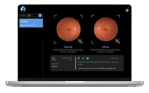 AI technology that diagnoses referable diabetic retinopathy from retinal images obtained by a handheld camera.